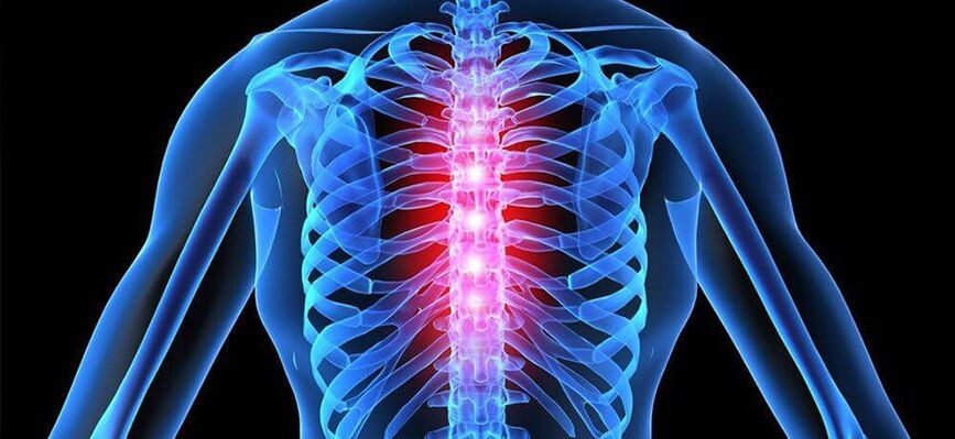 Острата болка е характерна за обостряне на остеохондрозата на гръдния кош. 