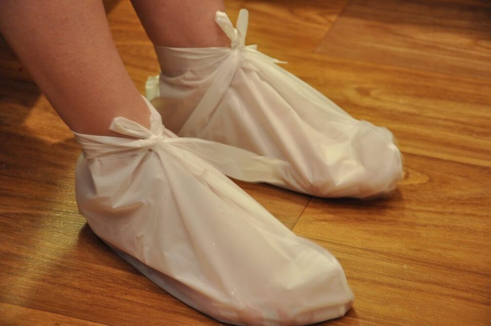 компреси за артроза на глезена