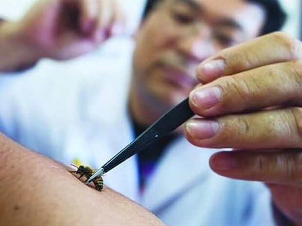 апитерапия за цервикална остеохондроза