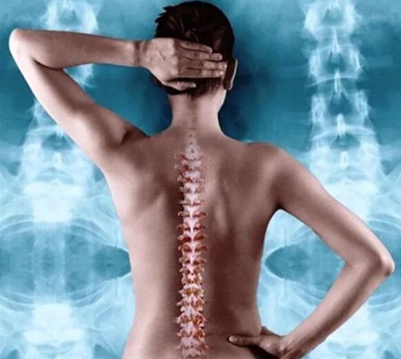 остеохондроза на гръбначния стълб и гръдния кош